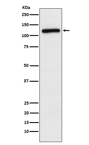 APLP2 Rabbit mAb